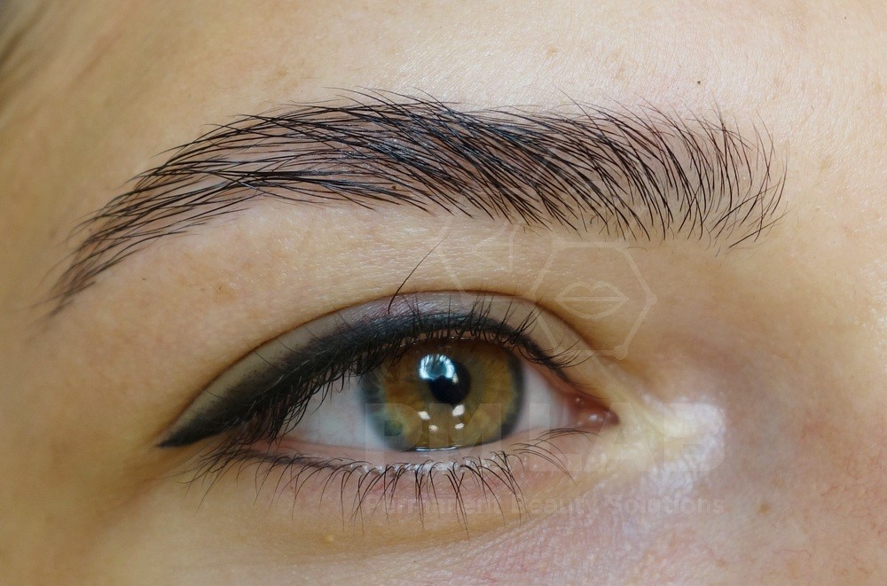 Permanent make up for lower eyelids 