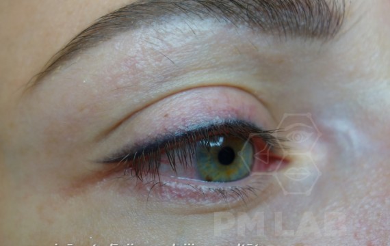 Eyes micropigmentation. What fits your eyes? 